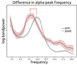 Language-training induced changes of peak frequencies in stroke patients with aphasia